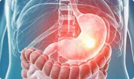 Normalizuje pracę jelit